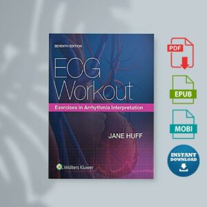 ECG Workout Exercises in Arrhythmia Interpretation 7th Edition
